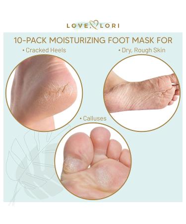 Moisturizing Foot Mask (10pk) for Dry Cracked Feet - Foot Care Gift Set for Women - Includes Moisturizing Socks - Ideal Mother's Day Gift! 10 Count - Buy Online on GoSupps.com
