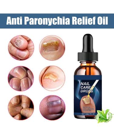  JINGLING JINGLING Toenail Strengthener | 15ML Gentle Nourishing Solution - Strengthening Nail Drops | For Dryness Redness Thickening Women's and Men's Manicure at Home or in a Salon - Buy Online on GoSupps.com