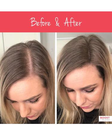 Boost N Blend Medium Brown Female Hair Thickening Fibers - Vegan Scalp Concealer and Hair Filler for Thinning Hair (25g) - Buy Online on GoSupps.com