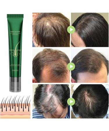 Ginger Hair Oils for Hair Growth - Ginger Hair Growth Serum - Hair Care for Dry Damaged Hair - Moisturize Repair Thin Root Restore Follicles Essence - Strengthen Stimulate Scalp Regrowth Reduce Loss - Buy Online on GoSupps.com