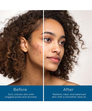 Neptune Skincare 3-Piece Bundle | Fresh Water Cleanser Deep Sea Hydrate Moisturizer & Black Sea Mud Scrub | Deep Cleansing Hydrating & Exfoliating | 100% Natural EWG Verified | For All Skin Types - Buy Online on GoSupps.com