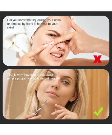 BEZOX Blackhead Tweezer and Acne Needle Set - Stainless Steel Comedone Extractor Kit - Buy Online on GoSupps.com