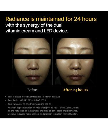 Buy MEDITHERAPY VITA REAL Toning Laser Cream - Hydrating Vitamin C & E Moisturizer with LED Device for Brightening Uneven Skin Tone | Korean Skincare 1.7 fl.oz - International Shipping Available - Buy Online on GoSupps.com