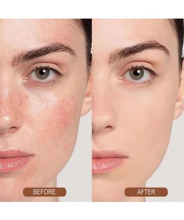  Generisch Brightening Gel - Moisturizing Skin Gel - Brightening & Moisturizing Formula - Lightweight Care Accessory for Daily Use Radiant Complexion & Moisturizing Care - Buy Online on GoSupps.com