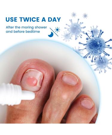 Fungal Nail Treatment - Fungal Nail Treatment for Toenails Extra Strong - Anti Fungus Nail Repair and Strengthen - Toenail Fungus Treatment for Thickening Yellow-Brown Discoloration Ragginess 20ML - Buy Online on GoSupps.com