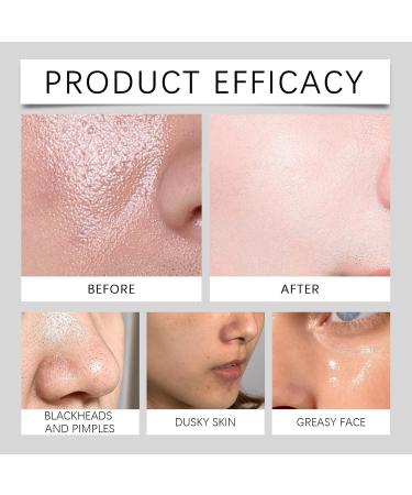 Gentle Exfoliating Facial Cleanser - Remove Blackheads Deep Clean Pores Brighten Skin Moisturize Vitamin E Face Wash(2PCS) - Buy Online on GoSupps.com