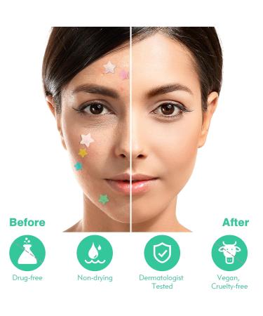 Star Pimple Patches (240 Counts) - Hydrocolloid Acne Dots with Tea Tree Oil in 3 Sizes & 6 Colors for Effective Blemish Removal - Buy Online on GoSupps.com
