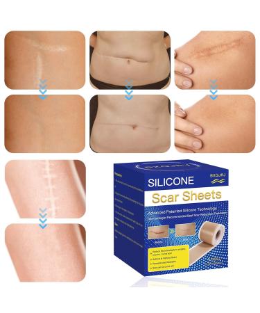 Silicone Scar Sheets 6 Pack for C-Section, Surgery, Burn, Post-Acne & Stretch Marks - 4x150cm - Buy Online on GoSupps.com