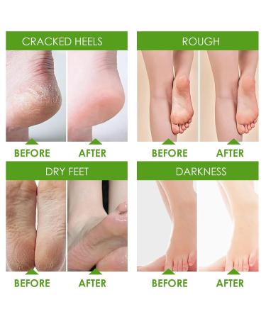 Exfoliating Foot Mask - 2 Pairs of Cornea Socks for Men & Women | Effective Foot Care for Tender Feet | Vera Green - Buy Online on GoSupps.com
