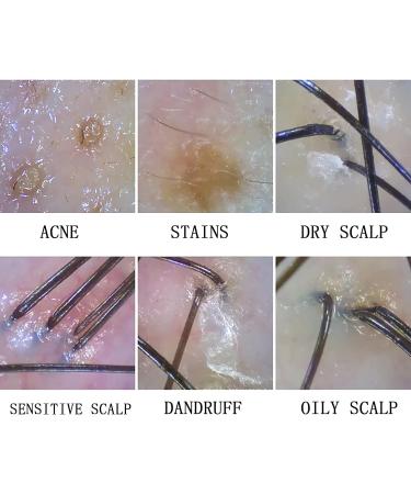 Skin Diagnosis Hair Analyzer 800 Times Magnification Wireless WiFi Hair Follicle Hair Tester for Skin Care Beauty Help Physicians or Hygienists Observe The Scalp of Patients. - Buy Online on GoSupps.com