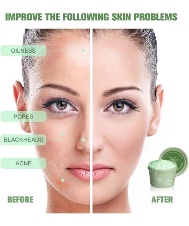 Green Tea Clay Mask Matcha Mud Mask Hydrating Moisturizing Deep Pore Cleansing Acne Treatment Green Tea Purifying Clay Mud Mask Blackhead Remover Mask Face Masks for Woman Man - Buy Online on GoSupps.com