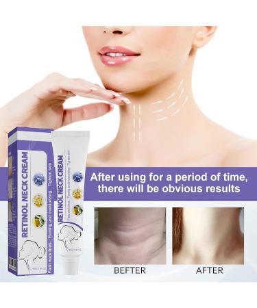 3 Pack Retinol Neck Cream for Wrinkles - Firming & Hydrating Neck Treatment with Antioxidants - 1.41 oz Anti-Aging Neck Care Cream (3) - Buy Online on GoSupps.com