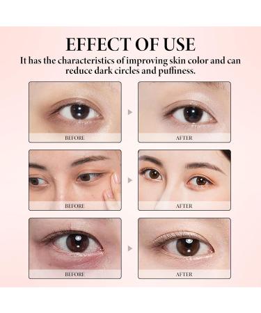 Retinol Eye Stick for Anti-Aging Under Eye Treatment with Castor Oil Coconut Oil & Squalane to Reduce Fine Lines Dark Circles Deeply Hydrating & Firming 0.1 oz - Buy Online on GoSupps.com