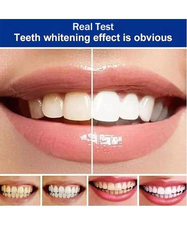 Sp-4 Toothpaste Natural Whitening Toothpaste Probiotic Whitening and Stain Removal Toothpaste Brightening Toothpaste Toothpaste for Fresh Breath - Buy Online on GoSupps.com