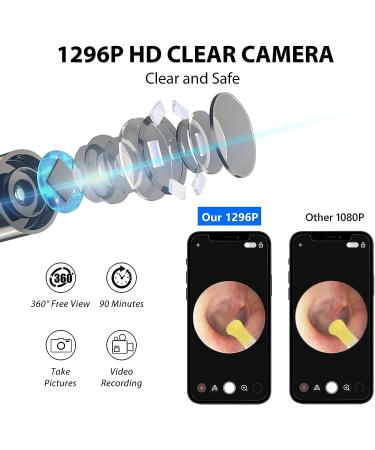 Ear Wax Removal Tool with 1296P Camera, 6 LED Lights & WiFi | Ear Cleaner Kit for iOS/Android - Black - Buy Online on GoSupps.com