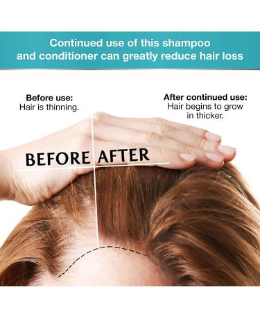 Biotin Hair Growth Shampoo and Conditioner Set - Regrowth Treatment for Thinning Hair - For Dry, Oily, Color Treated Hair - 2 Piece Set - Buy Online on GoSupps.com