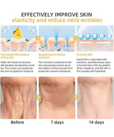 gifyym Bee Lift Cream Biancat Luxeradiance Bee Lift Cream Bee Cream Bee Gift Bee Venom Face Lift Cream The facial cream for repairing damaged skin - Buy Online on GoSupps.com