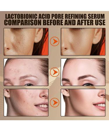 Retinoid 2% Emulsion Retinol Serum Serum High Strength for Face Retinol Face Serum Anti Wrinkle Serum Fade Fine Lines Skin Repair Serum for Women & Men Strength Face Serum 2 * 30ML - Buy Online on GoSupps.com