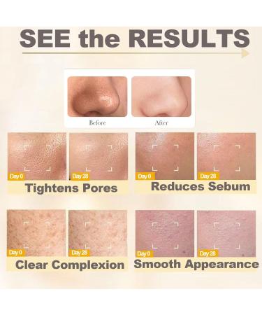 100ML White Rice Peeling Glow Ampoule Gentle Rice Exfoliating Face and Body Scrub for Removing Sebum Dead Skin Cells Black Pore Deep Cleaning Fit for All Skin Types - Buy Online on GoSupps.com