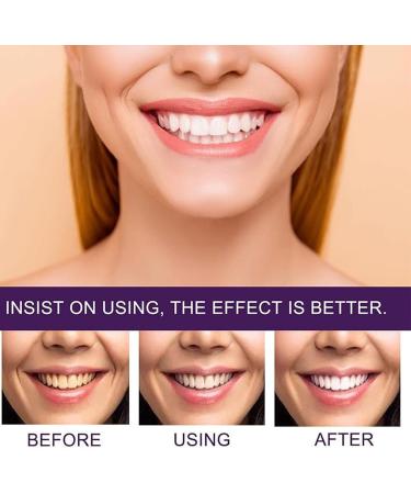 7 Pro Strong Whitening Toothpaste 7 Pro Intense Whitening Toothpaste 7 Pro Deep Whitening Toothpaste with 7 Probiotics Get a Brighter Smile (2 pcs) - Buy Online on GoSupps.com