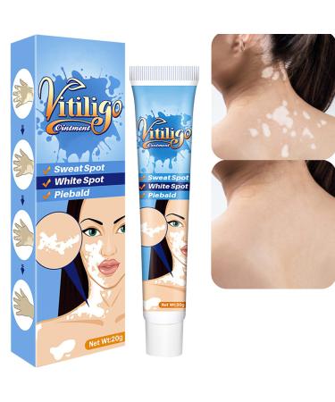 Vitiligo Cream  Vitiligo Treatment for Skin Vitiligo  Vitiligo Care Cream for Reduce White Spots and Improve Skin Pigmentation