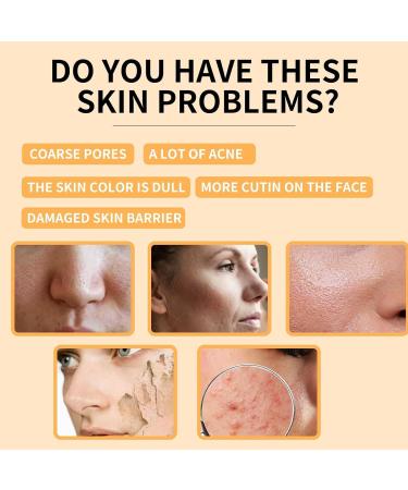 Glycolic Acid 7% Toning Solution Face Toner Face Serum for Women-Hyaluronic Acid Serum for face Moisturize & Strengthen-Dark Spot Corrector for Face Brightening Lifting Repair Acne - Buy Online on GoSupps.com