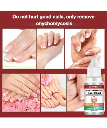 Fungal Nail Treatment - Extra Strong Solution for Toenail Fungus & Ingrown Toenails - Buy Online on GoSupps.com