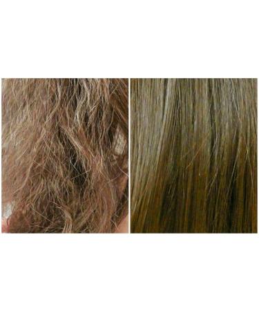 Magic Fast Growth Herbal Hair Oil - Special Blend for Damaged Hair | Only $0.25/Day | International Shipping to USA - Buy Online on GoSupps.com