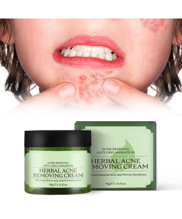 Acne Cream For Face Herbal Acne Removing Cream Acnecide Cream Spot Cream For Acne Spot Cream For Teenagers Acne Scar Removal Cream Moisturiser Tea Tree Cream Balance Facial Oil Cream