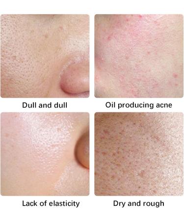 KOAHDE Dragon's Blood Easy Cream for Anti Wrinkle Dragon Blood Easy Cream Dragon Blood Serum Face Moisturizer Dragon Blood Anti Aging Anti Wrinkle Face Cream Retinol Elastic Firming Cream 15G - Buy Online on GoSupps.com