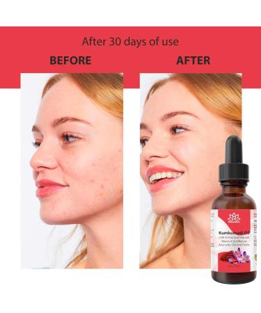 Relaxcation Pure Kumkumadi Oil | Ayurvedic Botanical Blend with 24 Plant Extracts & Saffron | Cold Pressed Natural Oil for Face Glow & Radiance | Glass Bottle | Travel Size (4 oz) 4 Fl Oz (Pack of 1) - Buy Online on GoSupps.com