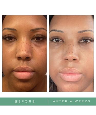 Replenix Brightening Eye Cream - 0.5 oz - Dark Circle Treatment for Under Eye Puffiness - Buy Online on GoSupps.com