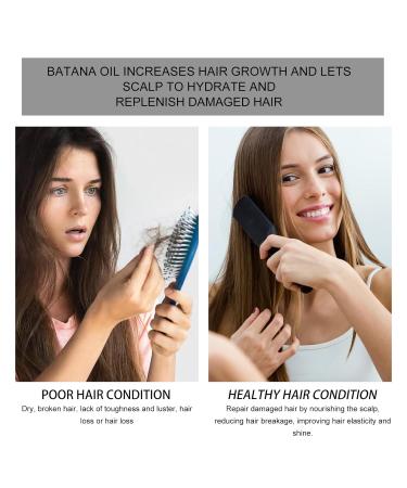 Batana Hair Oil for Growth - 100% Raw Batana Butter Oil from Honduras | Anti-Hair Loss & Thicker Hair | Perfect Women's Gift - Buy Online on GoSupps.com