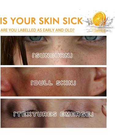  Generisch Women's Facial Oil 30ml Brightening Moisturizing Cream for Skin Care - Moisturizing Face Oil | For Beauty Day and Night Makeup for Women and Men - Buy Online on GoSupps.com