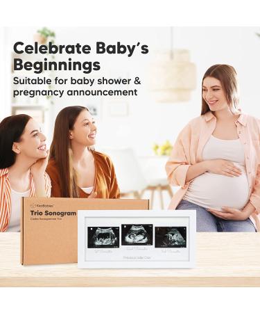Sonogram Picture Frame Trio - Ultrasound Frames for Mom to Be - Baby Nursery Decor - Pregnancy Announcement Gift - Pregnant Mom Gifts (Alpine White) - Buy Online on GoSupps.com