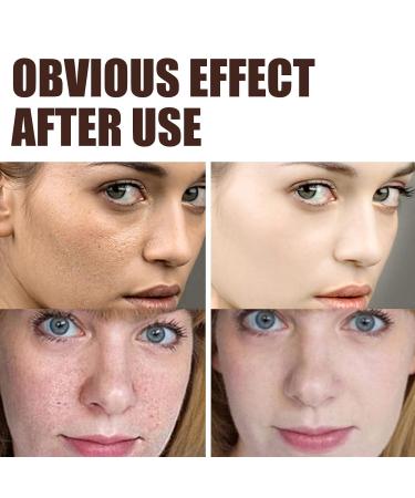 Retinol Anti-Aging Wrinkle Removal Firming Facial Cream Set - 3Pcs - Buy Online on GoSupps.com