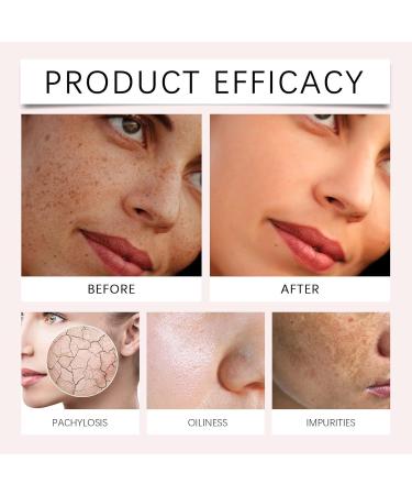 Gentle Facial Cleanser - Oil/Dirt Removal Pore Unclogging Oil-Balancing Moisturizing Non-Greasy(3PCS) - Buy Online on GoSupps.com