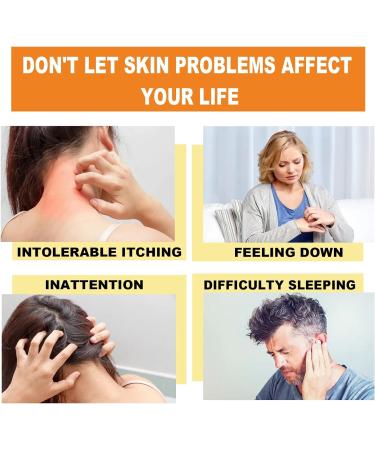 GIMMAV Bee Venom Psoriasis Treatment Cream - New Zealand Professional Solution for Soothing Skin - 8pcs - Buy Online on GoSupps.com