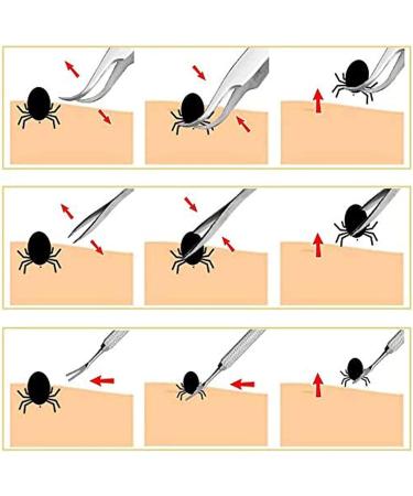 AFTREN Tick Remover Pet Care Tool Set Flea Comb Real Bamboo Contour Grip Handle Dogs Cats Horses 5 Pcs Stainless Steel Fleas Ticks Remover Kit - Buy Online on GoSupps.com