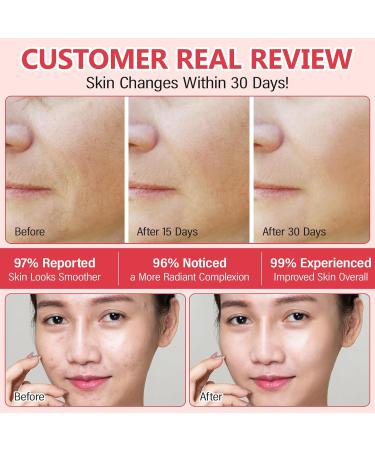  SONGVISON 4PCS collagen night mask collagen gelatin cream hydrols-collagen mask elasticity and hydration pore strengthening smoothing and firming - Buy Online on GoSupps.com