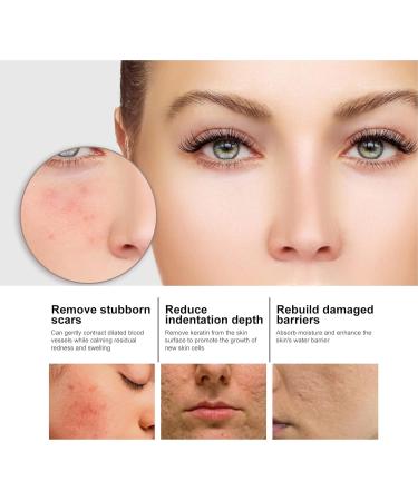 50ml Facial Nicotinamide Serum Nicotinamide Hydrating Serum Spots Removal Minimizing Pores Nicotinamide Brightening - Buy Online on GoSupps.com