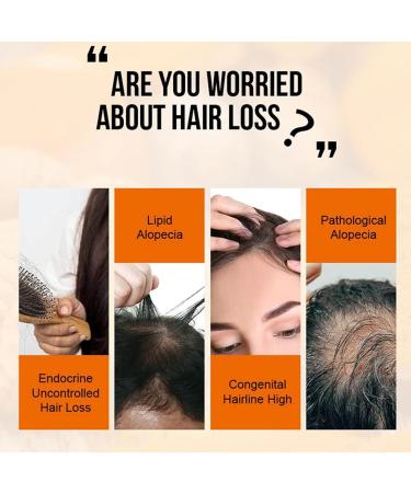 Savvy High Hair Growth Purc Oil - Hair Density Essential Oil Serum for Natural Regrowth, Anti-Frizz & Dry Hair Care - 2 pcs - Buy Online on GoSupps.com