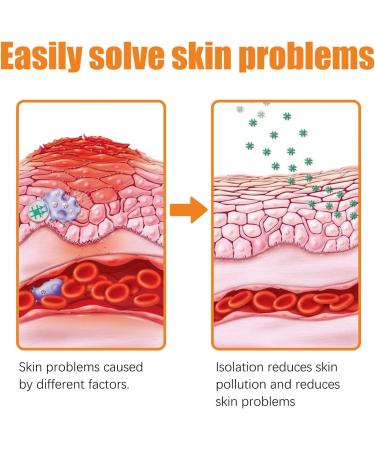 Professional Psoriasis Treatment Cream with New Zealand Bee Venom - Soothing and Moisturizing Formula for Youthful Skin (2pcs) - Buy Online on GoSupps.com