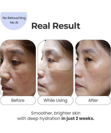 Petite Pluie 50 PCS Wrinkle Patches for Face with Collagen, Hyaluronic Acid & Peptides - Korean Face Lift Tape - Made in Korea - Buy Online on GoSupps.com