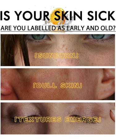 Aobenz Spot Remover for Face Dark Spot Correcting Serum Anti Spot Serum Dark Spot Remover for Face Freckle Remover Hydrating Serum Skincare Serum 50ml - Buy Online on GoSupps.com