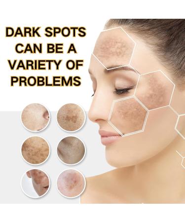 Brightening Repair Face Cream - Face Cream for Women - Face Moisturiser for Dark Spot Correcting - Moisturizing and Anti-Blemish Spot Cream - Buy Online on GoSupps.com