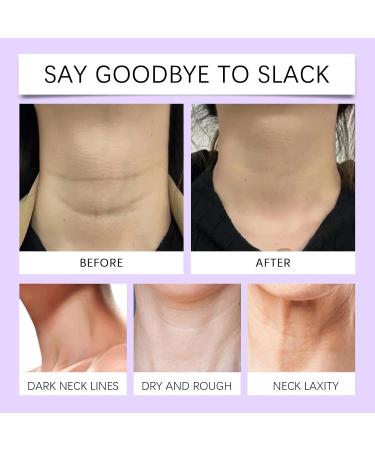 YOENBG Firming cream for the neck firms and lifts sagging skin with double roller massage antiaging moisture and lifting cream for neck and d collet repairs the skin 2 - Buy Online on GoSupps.com