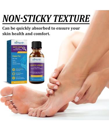 Wart Remover Liquid Fast Acting Salicylic Liquid to Remove Common and Plantar Warts Flat Warts 0.7 Fl Oz 1 Count - Buy Online on GoSupps.com