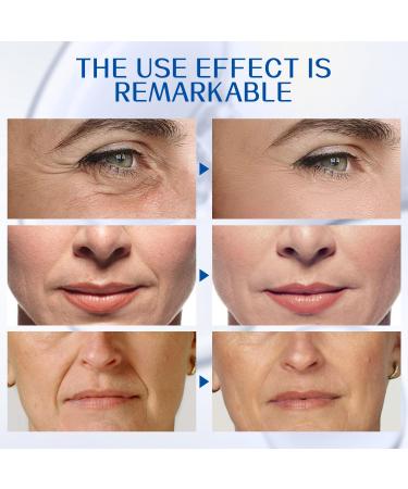 Botox Face Serum - Anti-Aging & Wrinkle Reducing with Vitamin C & E - 2PCS | Boost Skin Collagen & Plump Skin - Buy Online on GoSupps.com