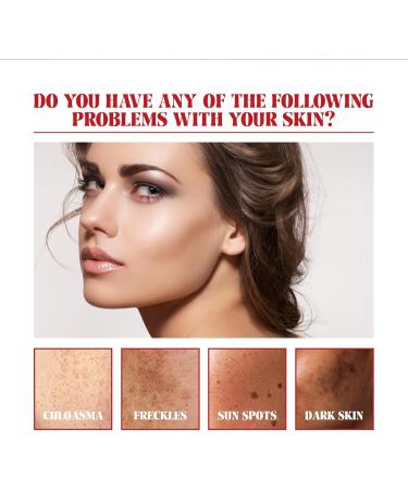 Melasma Treatment for Face Removes Facial Melasma Dark Spots Spot Cream Hyperpigmentation Treatment Sun Spots and Melasma Freckle Remover Remove Dark Spots Pigmentation Removal Cream for Face - Buy Online on GoSupps.com